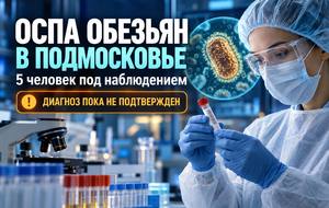 Оспа обезьян в Подмосковье: 5 человек под наблюдением, результаты анализов ожидаются